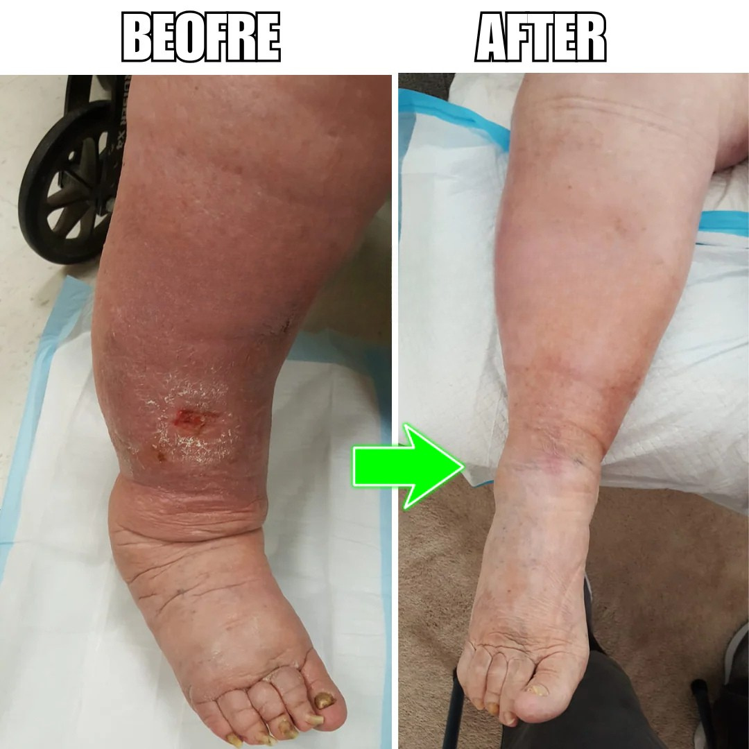 Velavor® Calf Compression Wrap For Circulation & Swollen Calves (1 wrap)